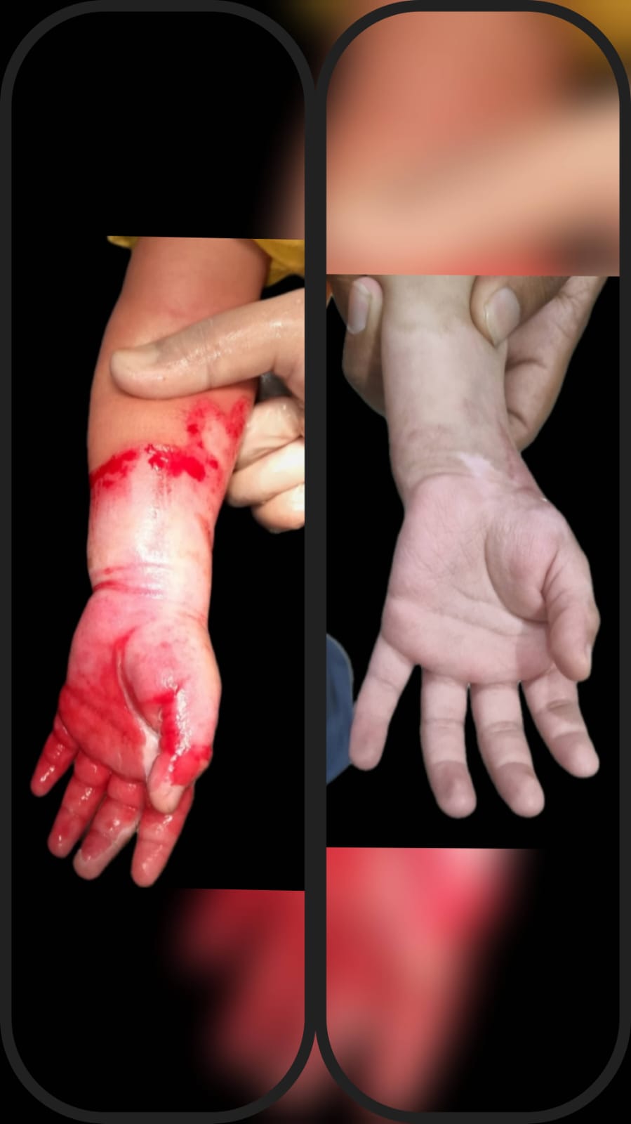Before & After 38